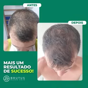 brutus-blend-hair-2-meses.jpeg