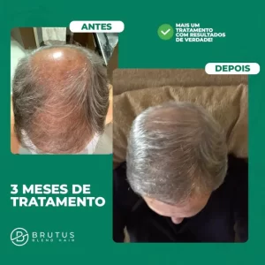 brutus-blend-hair-3-meses-v2.jpeg